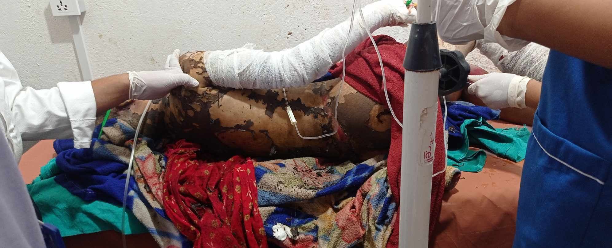 दार्चुलामा एक महिलाले गरिन मट्टीतेल छर्केर आत्मदाहको प्रयास